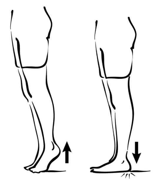 Correct Flat Feet