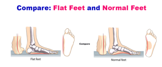 Flat best sale foot workout
